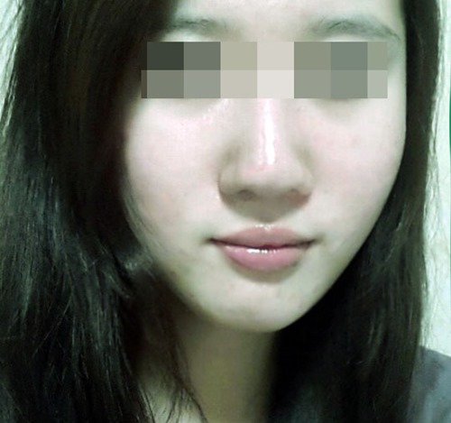 포샵+여드름관리 에프터보정.jpg