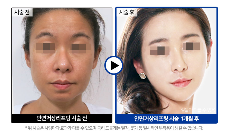 슬라이드
