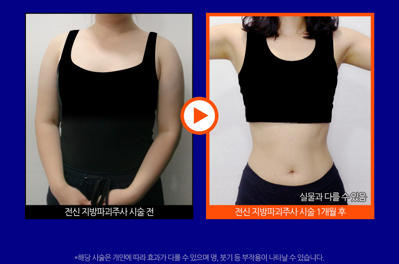 슬라이드