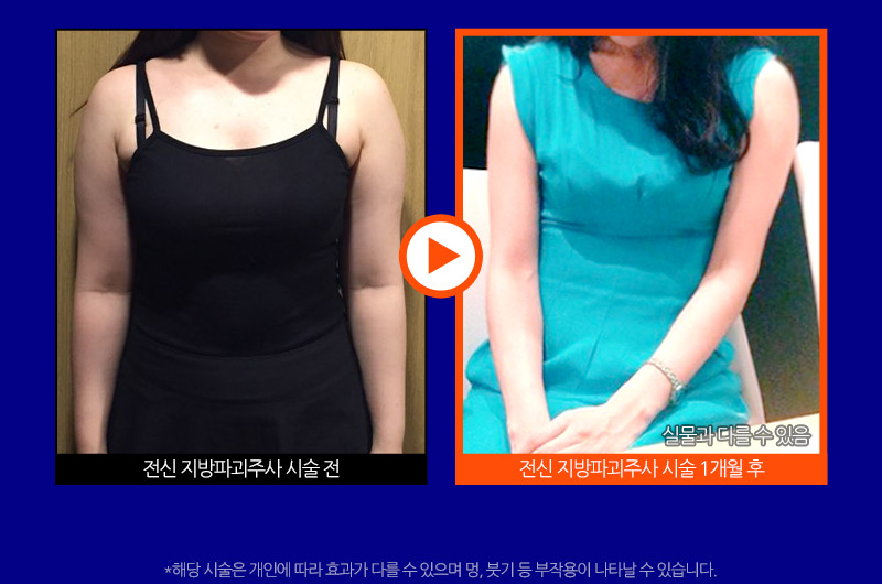 슬라이드